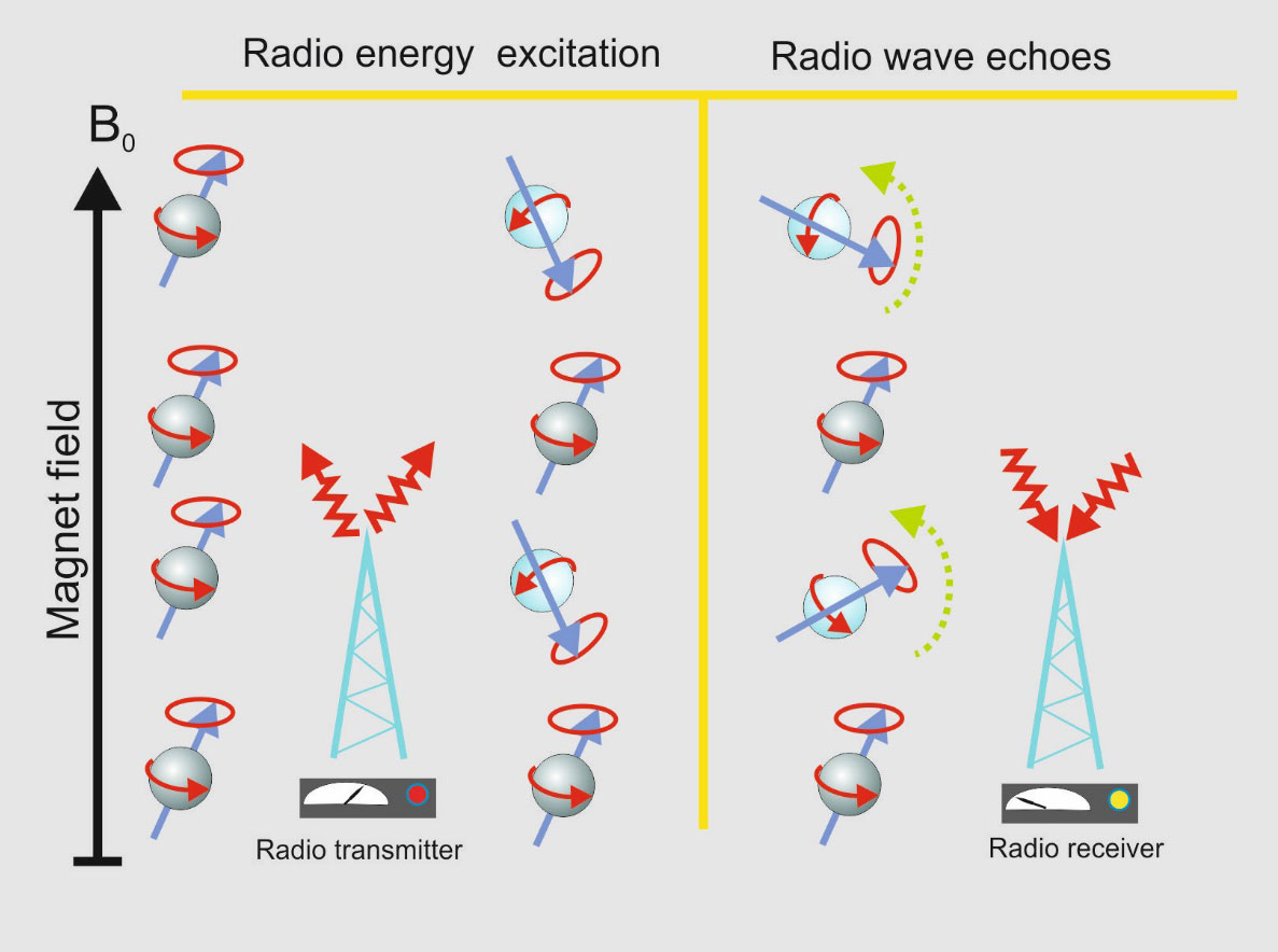 I hyperpolarisering bruges radiobølger, og lederen af MR Centret sammenligner teknikkens følsomhed med at kunne høre nærradio fra Madrid i Århus. Foto: MR Centret